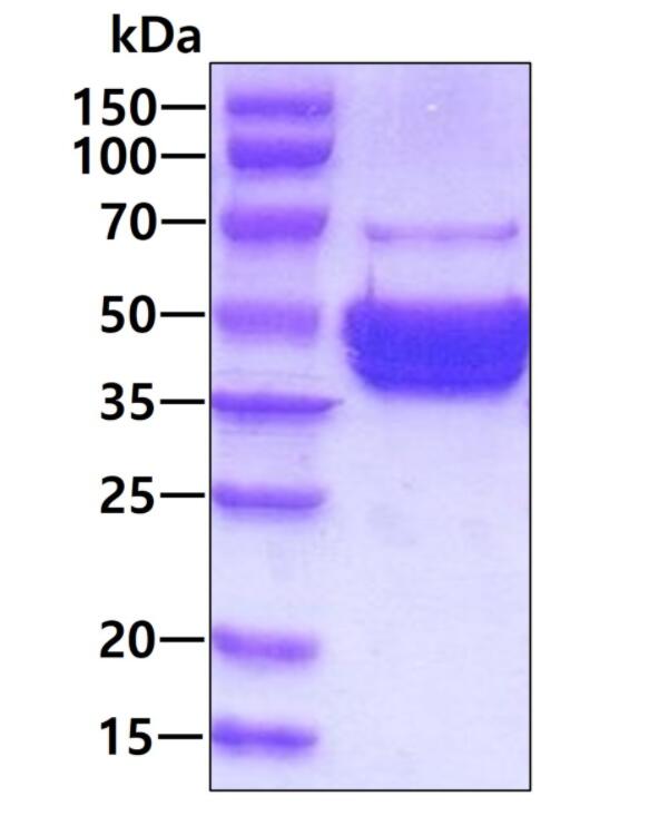 3 μg by SDS-PAGE under reducing condition and visualized by coomassie blue stain